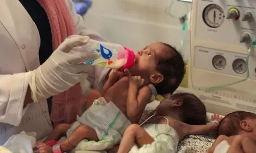 ولادة نحو 20 ألف طفل في «جحيم» الحرب في غزة