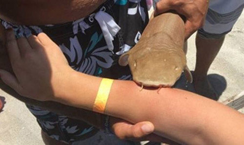 US woman rushed to hospital with shark stuck to arm