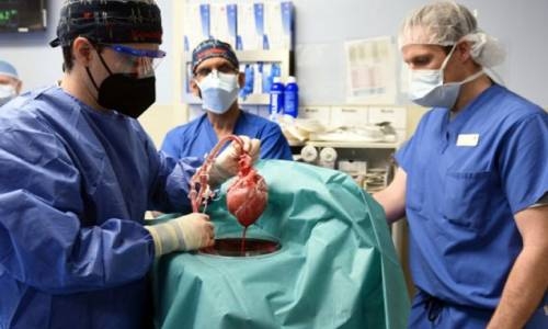 US man recovering after 'breakthrough' pig-heart transplant