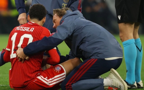 Bayern knew about Musiala's condition 'a long time ago' says Kompany Bayern knew about Musiala's condition 'a long time ago' says Kompany