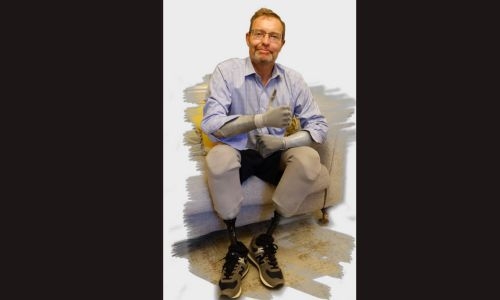 UK 'bionic MP' returns to parliament after quadruple amputation