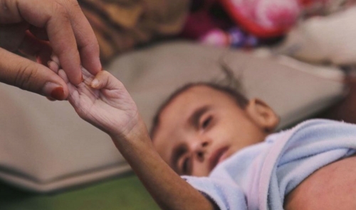 21 Children Die from Starvation as EU Urges Israel to Halt Civilian Deaths at Aid Points