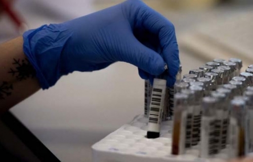 Virus was already in Italy by December, study finds