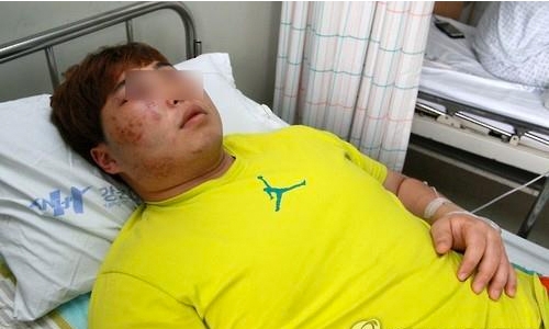 Former S. Korean champion suspended for assault