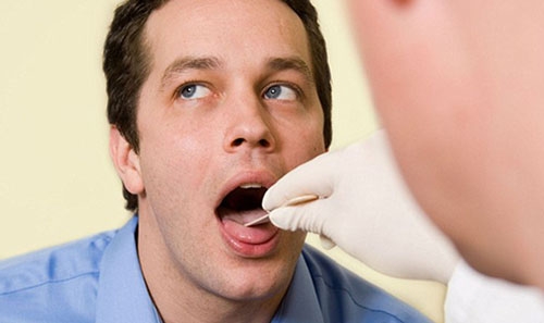 New saliva test can check you for cancer