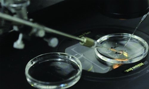 Scientists create first human-pig embryos