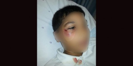 Teacher beats 11-year-old Teacher beats 11-year-old