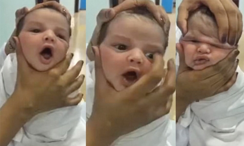Saudi fires nurses for squashing a newborn baby’s face