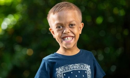 Bullied Australian boy with dwarfism lands role in 'Mad Max' movie