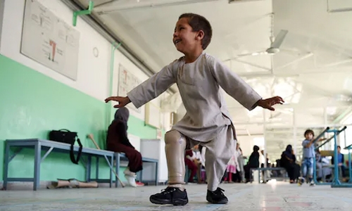Young Afghan amputee’s joy at dancing on new leg