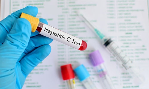 Bahrain launches  hepatitis C-free country campaign