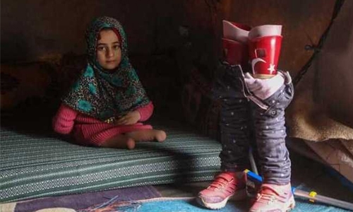 She was born without legs, but she didn’t stop trying She was born without legs, but she didn’t stop trying