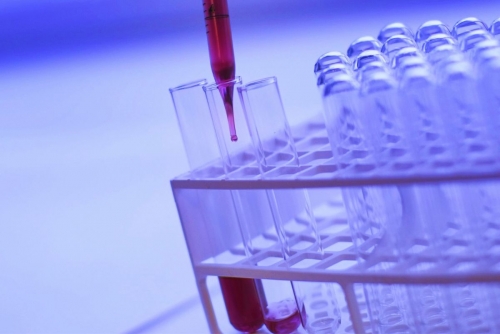 New AI Blood Test Offers Early Alzheimer’s Detection