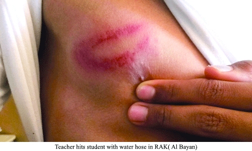 Teacher hits student with water hose in RAK