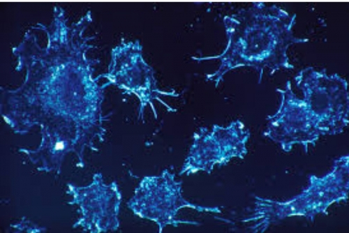 Abu Dhabi scientists create cancer-busting substances that show up on MRI scans Abu Dhabi scientists create cancer-busting substances that show up on MRI scans