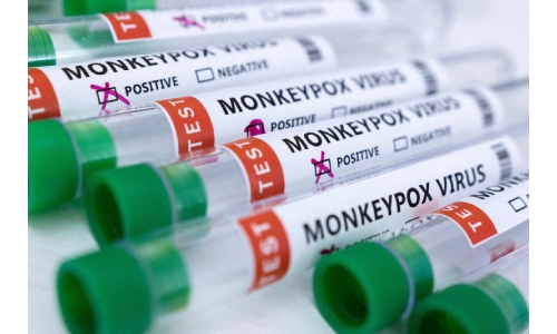WHO says monkeypox not currently a global health emergency