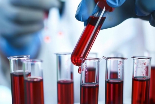 UAE Becomes First Nation to Adopt Blood Test Detecting 70+ Cancers 