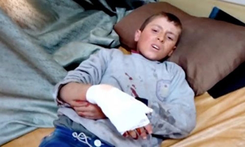 Missile strikes on north Syria schools, hospitals kill 50: UN Missile strikes on north Syria schools, hospitals kill 50: UN