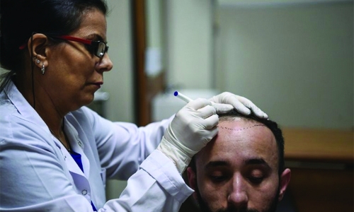 Hair therapy boosts Istanbul's receding tourism