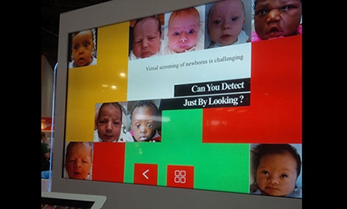 App to detect birth defects in infants