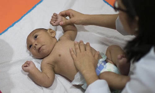 Zika-hit nations should allow access to contraception, abortion: UN Zika-hit nations should allow access to contraception, abortion: UN