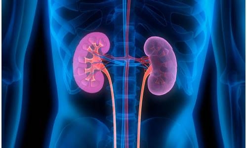 Three critical actions to address the neglected crisis of chronic kidney disease