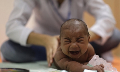 Babies with ‘normal’ heads  may have Zika brain damage