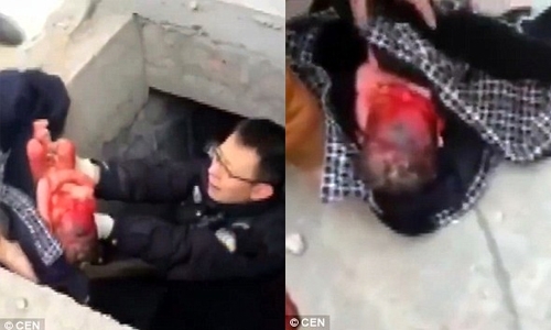 Newborn baby rescued from a drain Newborn baby rescued from a drain