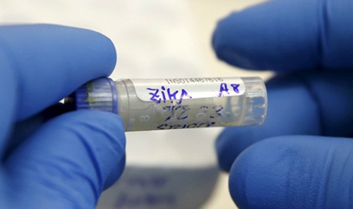 Zika detected in urine, saliva: top Brazilian researchers