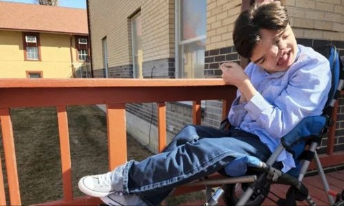 Boy born with two faces celebrates his 18th birthday