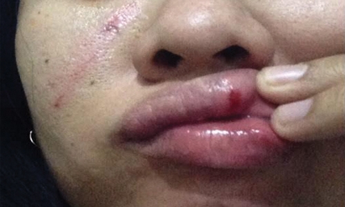 Expat survives rape attempt in the middle of the desert 