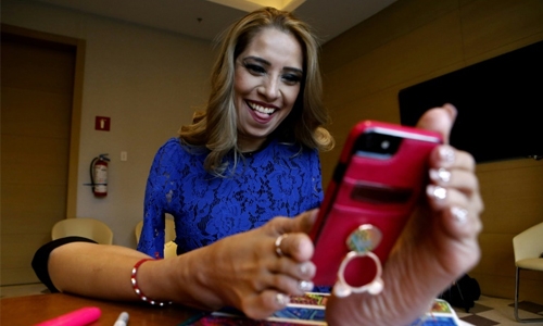 Mexican overcomes disability in style Mexican overcomes disability in style