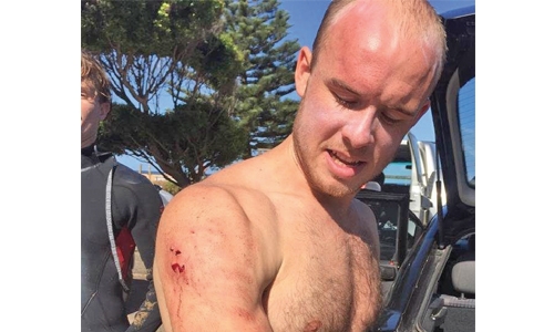 British doctor ‘punches  shark’ to survive attack