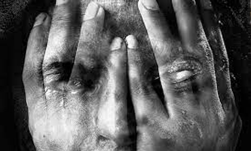 Bahraini man disfigures divorcee’s face Bahraini man disfigures divorcee’s face