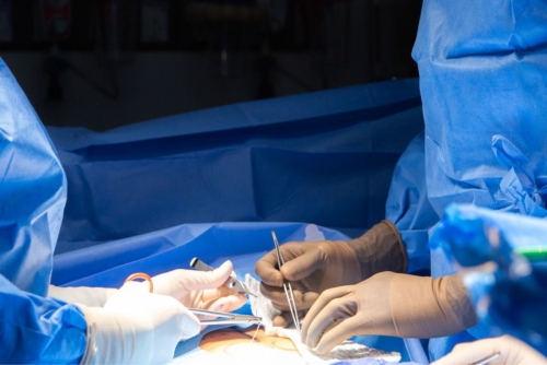 How 'BBL Smell' is Becoming the Most Talked-About Post-Op Secret