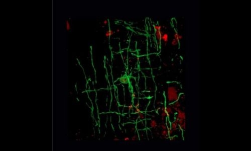 Ancient viruses responsible for our big brains and bodies, says study Ancient viruses responsible for our big brains and bodies, says study