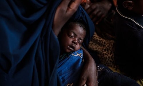 Undernutrition in mothers is rising sharply: UNICEF Undernutrition in mothers is rising sharply: UNICEF