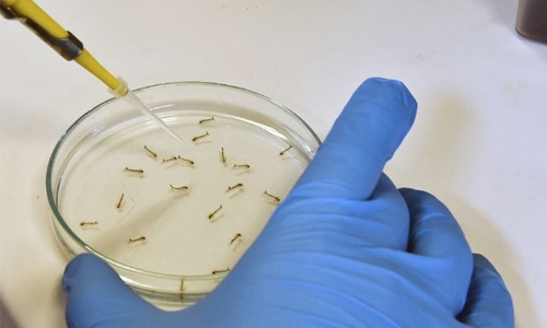 Thais probe babies with microcephaly for Zika link