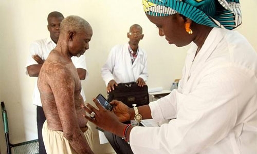 New app helps Mali skin doctors reach out to distant patients