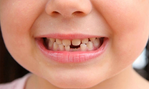 Goodbye tooth decay, welcome stronger teeth