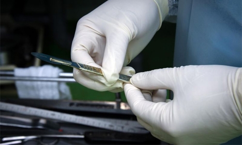 Nine US deaths linked to breast implant-associated cancer Nine US deaths linked to breast implant-associated cancer