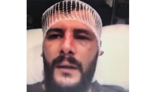 Hunt for culprits who attacked security guard in Bahrain 