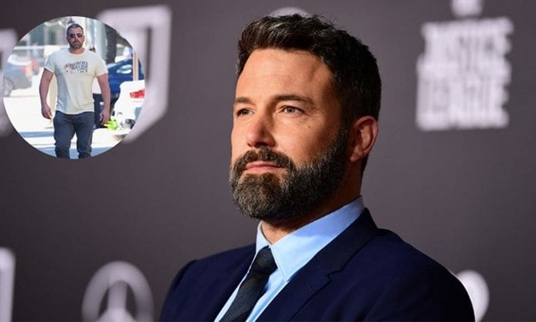 Ben Affleck looks fit during rehab stint Ben Affleck looks fit during rehab stint