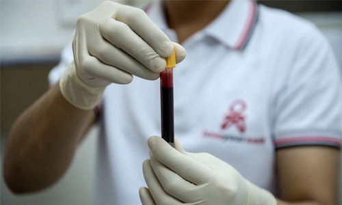 Philippines has fastest growing HIV infections in Asia: UN