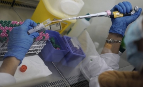 French virus testing labs under strain amid resurgent demand