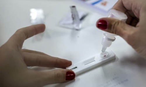 A sixth of new HIV patients in Europe 50 or older