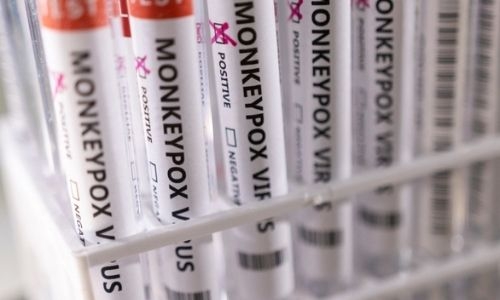 UK allows people infected with monkeypox to isolate at home UK allows people infected with monkeypox to isolate at home