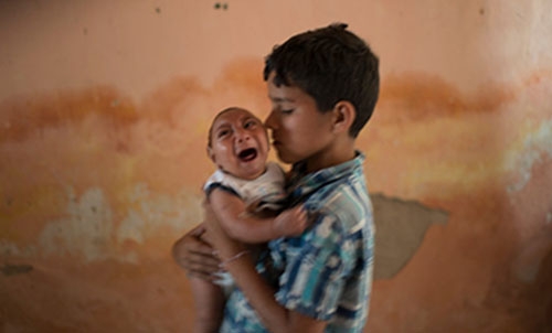 Brazil finds Zika in microcephaly babies' brains Brazil finds Zika in microcephaly babies' brains