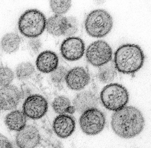 Hantavirus Outbreak on Cruise Ship: 7 Cases Confirmed or Suspected, WHO Reports