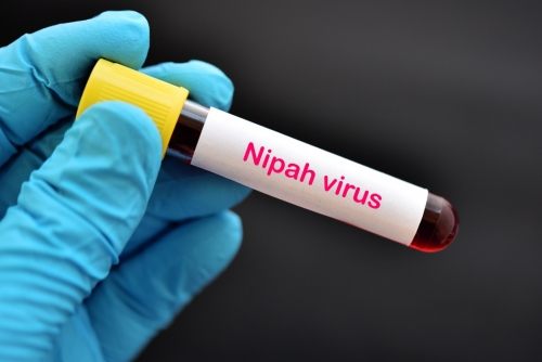 Thailand, Nepal, Taiwan Step Up Surveillance Amid Nipah Virus Outbreak